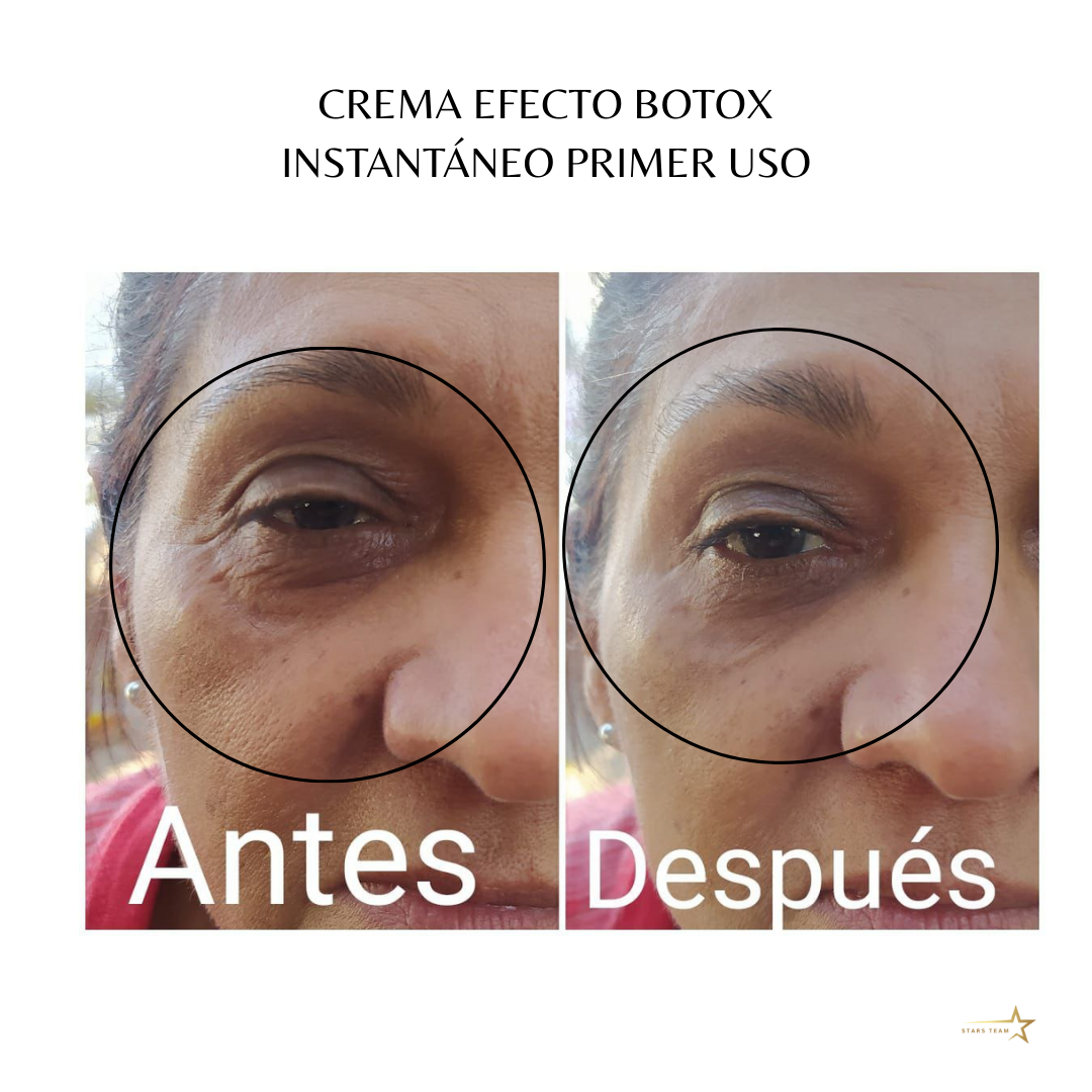 Crema Perfeccionadora Farmasi – Efecto Botox Instantáneo
