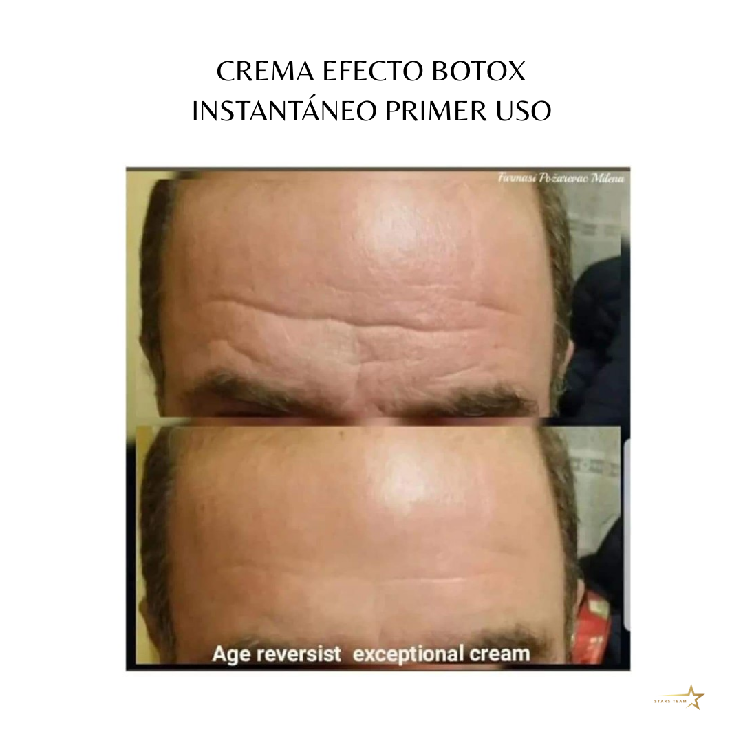 Crema Perfeccionadora Farmasi – Efecto Botox Instantáneo