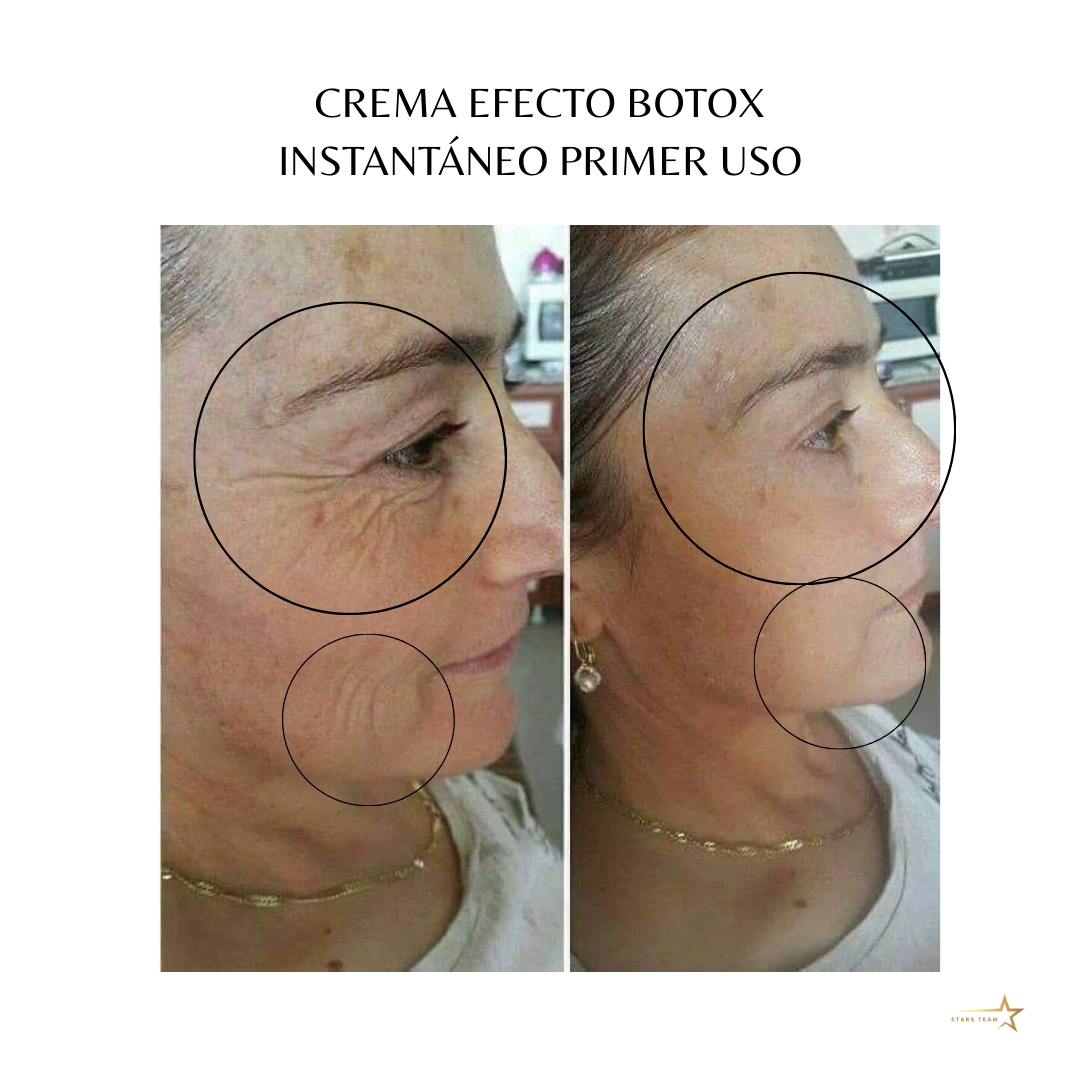 Crema Perfeccionadora Farmasi – Efecto Botox Instantáneo