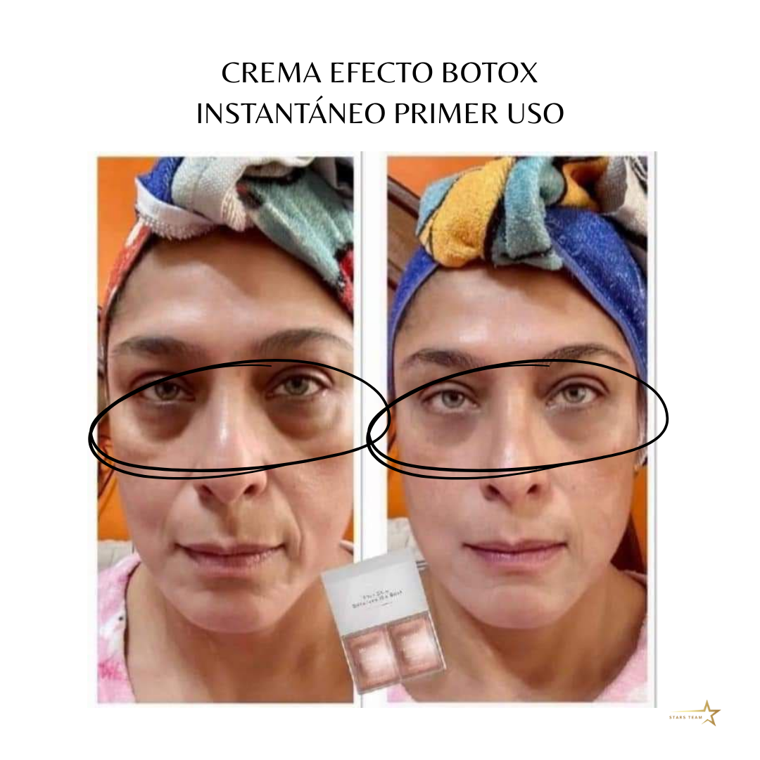 Crema Perfeccionadora Farmasi – Efecto Botox Instantáneo