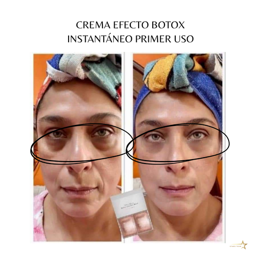 Crema Perfeccionadora Farmasi – Efecto Botox Instantáneo