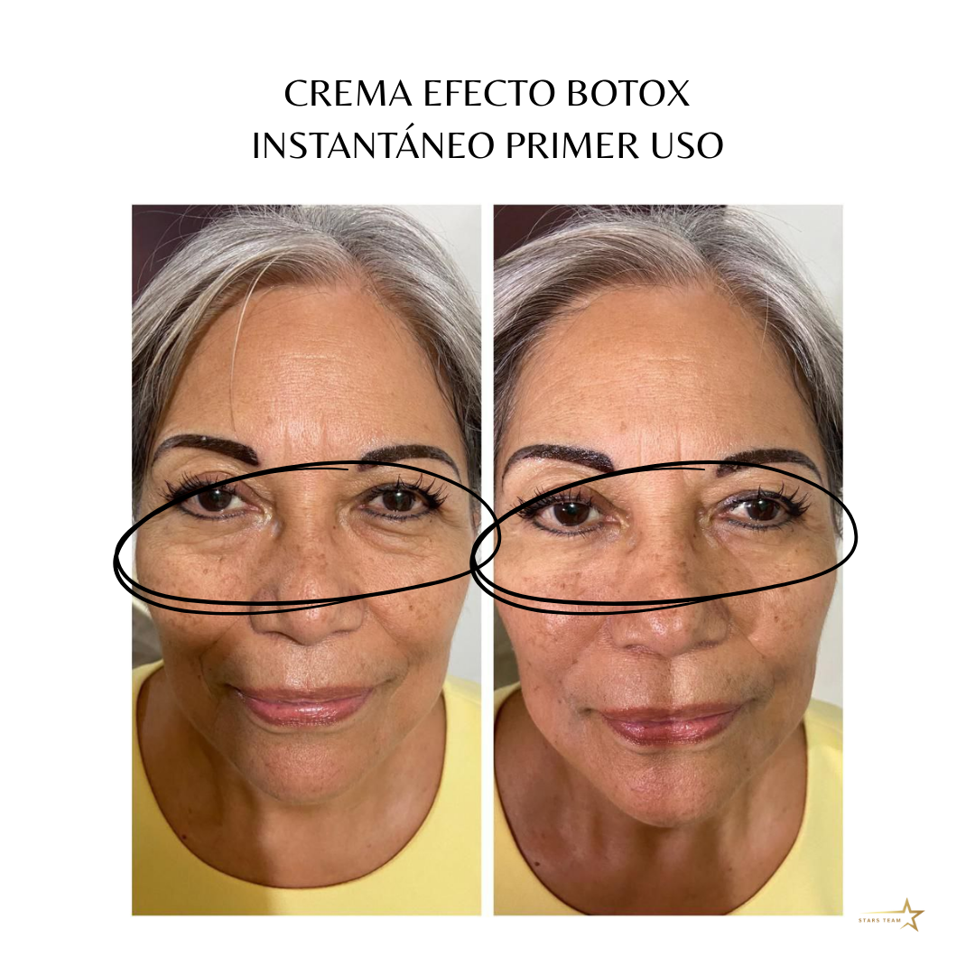 Crema Perfeccionadora Farmasi – Efecto Botox Instantáneo